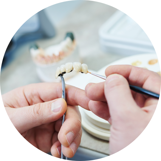 trattamenti_implant